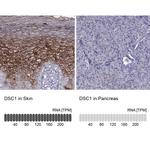 DSC1 Antibody