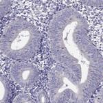 DSC1 Antibody in Immunohistochemistry (Paraffin) (IHC (P))