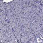 DSC1 Antibody in Immunohistochemistry (Paraffin) (IHC (P))