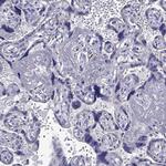 DSC1 Antibody in Immunohistochemistry (Paraffin) (IHC (P))