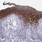 DSC1 Polyclonal Antibody