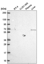 MTSS1 Antibody in Western Blot (WB)