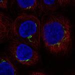 CENTB1 Polyclonal Antibody