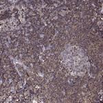 CENTB1 Antibody in Immunohistochemistry (Paraffin) (IHC (P))