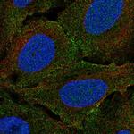 PLXNA4 Polyclonal Antibody