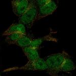 ZC3H6 Polyclonal Antibody