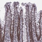 SNRPB2 Polyclonal Antibody