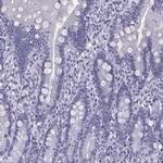 LOR Antibody in Immunohistochemistry (Paraffin) (IHC (P))