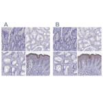 LOR Polyclonal Antibody