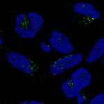 DPH5 Polyclonal Antibody