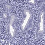 DNAH17 Polyclonal Antibody