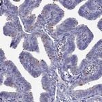 CDHR4 Antibody in Immunohistochemistry (Paraffin) (IHC (P))