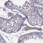 Norepinephrine Transporter Antibody in Immunohistochemistry (Paraffin) (IHC (P))
