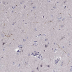 Norepinephrine Transporter Polyclonal Antibody