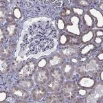 Norepinephrine Transporter Antibody in Immunohistochemistry (Paraffin) (IHC (P))
