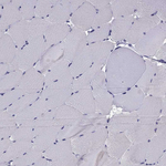 Norepinephrine Transporter Antibody in Immunohistochemistry (Paraffin) (IHC (P))