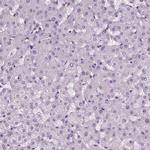 DRIL1 Antibody in Immunohistochemistry (Paraffin) (IHC (P))