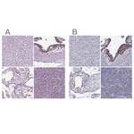 DRIL1 Polyclonal Antibody