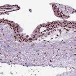 DRIL1 Antibody in Immunohistochemistry (Paraffin) (IHC (P))