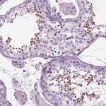 DRIL1 Antibody in Immunohistochemistry (Paraffin) (IHC (P))