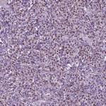 DRIL1 Antibody in Immunohistochemistry (Paraffin) (IHC (P))