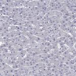 ZNF541 Polyclonal Antibody