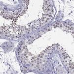 ZNF541 Antibody in Immunohistochemistry (Paraffin) (IHC (P))