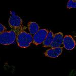 VCPKMT Polyclonal Antibody