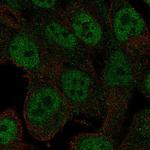 RNF113A Polyclonal Antibody