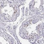 TZFP Antibody in Immunohistochemistry (Paraffin) (IHC (P))