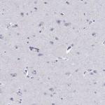 CAPNS2 Polyclonal Antibody