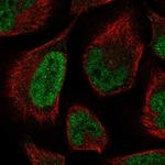 LCOR Polyclonal Antibody