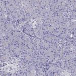 TEX14 Polyclonal Antibody