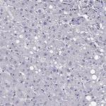 LMTK3 Antibody in Immunohistochemistry (Paraffin) (IHC (P))