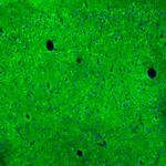 LMTK3 Antibody in Immunohistochemistry (Paraffin) (IHC (P))