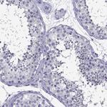 TSSK4 Antibody in Immunohistochemistry (Paraffin) (IHC (P))