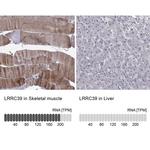 LRRC39 Antibody