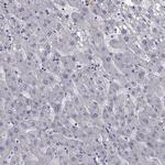 LRRC39 Polyclonal Antibody