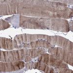 LRRC39 Antibody in Immunohistochemistry (Paraffin) (IHC (P))