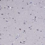 PRR18 Antibody in Immunohistochemistry (Paraffin) (IHC (P))