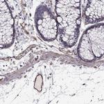 RASIP1 Polyclonal Antibody