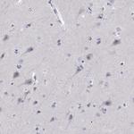 DOK3 Antibody in Immunohistochemistry (Paraffin) (IHC (P))