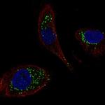 DNAJC5B Polyclonal Antibody