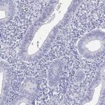 C14orf50 Polyclonal Antibody