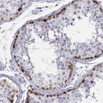 C14orf50 Antibody in Immunohistochemistry (Paraffin) (IHC (P))