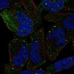 PCDHGB2 Polyclonal Antibody