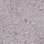 TMEM155 Antibody in Immunohistochemistry (Paraffin) (IHC (P))