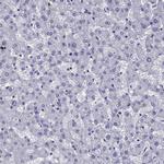 OLFM4 Polyclonal Antibody