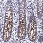 OLFM4 Antibody in Immunohistochemistry (Paraffin) (IHC (P))