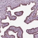 ZNRD1 Antibody in Immunohistochemistry (Paraffin) (IHC (P))